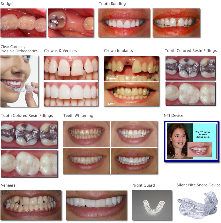 Services Before and After Pictures